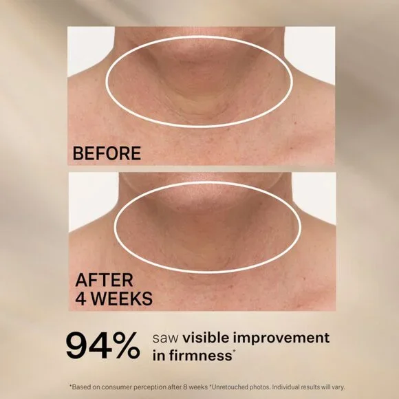 StriVectin TL Advanced™ Tightening Neck Cream PLUS Jumbo 3.4oz - Picture 3 of 7